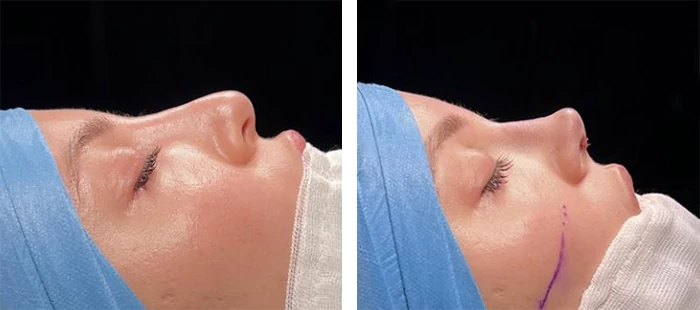 Dr Samil Sahin ENT Surgeon CV Photos Reviews More