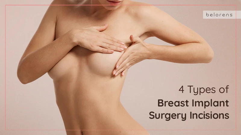 4 Types of Breast Implant Surgery Incisions