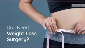 Do I Need Weight Loss Surgery? Which One Is The Best For Me?