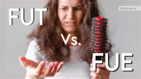Comparison of FUT and FUE: Two Common Hair Transplant Methods