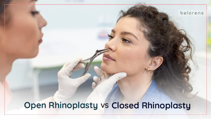 Open vs Closed Rhinoplasty: Everything You Need to Know
