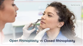 Open vs Closed Rhinoplasty: Everything You Need to Know