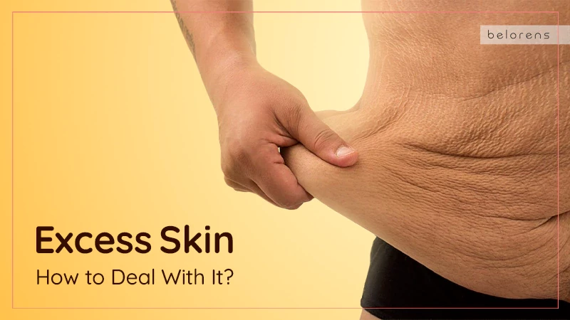 Excess Skin: How to Deal With It After Surgery or Weight Loss?