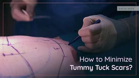 How to Minimize Tummy Tuck Scars?