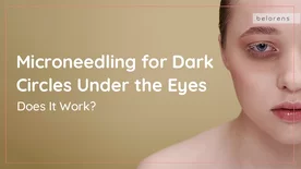 Microneedling for Dark Circles Under the Eyes: Does It Work?