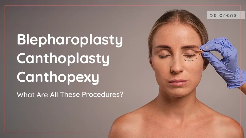 Blepharoplasty, Canthoplasty, Canthopexy: What Are All These Procedures?