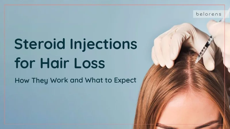 Steroid Injections for Hair Loss: How They Work and What to Expect