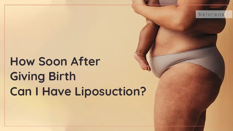 How Soon After Giving Birth Can I Have Liposuction?