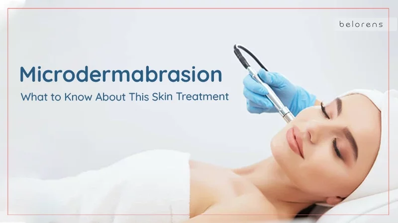 Microdermabrasion: What to Know About This Skin Treatment