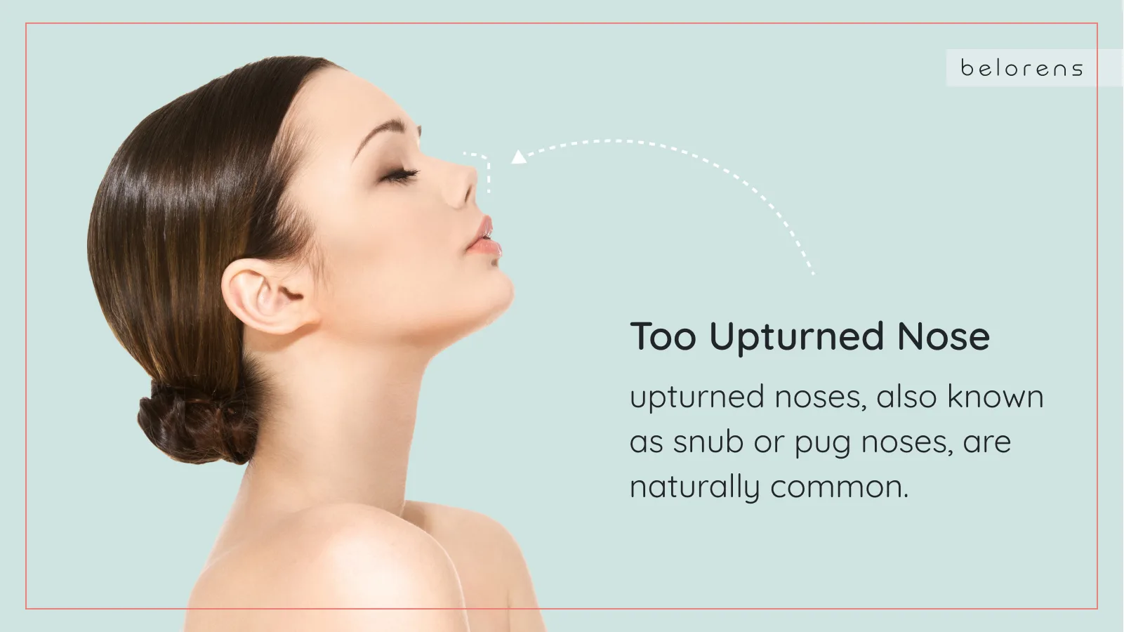 How to Tell Someone Had a Nose Job? Belorens