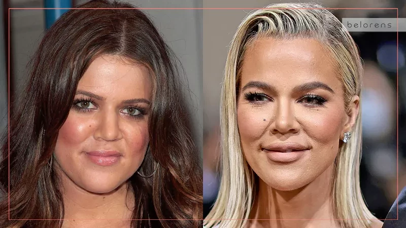 khloe before and after nose job Image 4