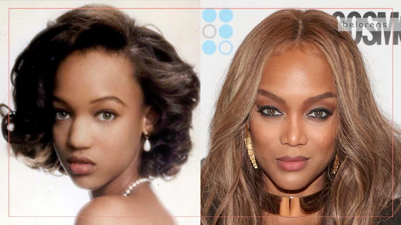 50 Celebrity Nose Jobs - before and after (Updated for 2024)