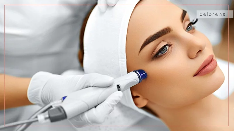 Microdermabrasion: Benefits, Procedure, Cost | Belorens