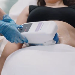 CoolSculpting