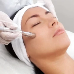 Dermabrasion