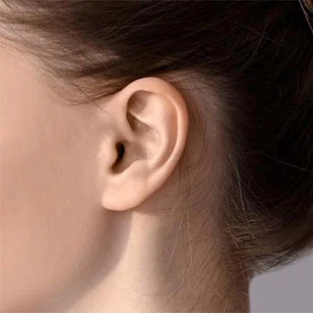 عملية إعادة بناء الأذن
