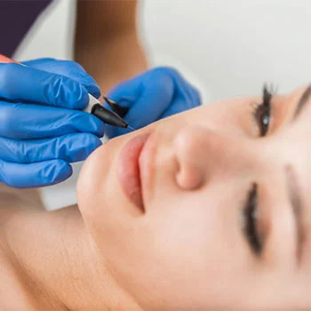 Electrolysis Hair Removal