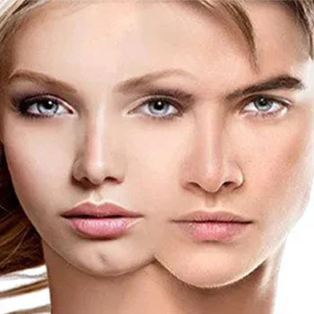 Facial Masculinization Surgery